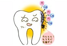 初期虫歯と再石灰化