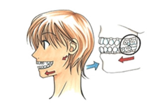 正しい歯並びの基本